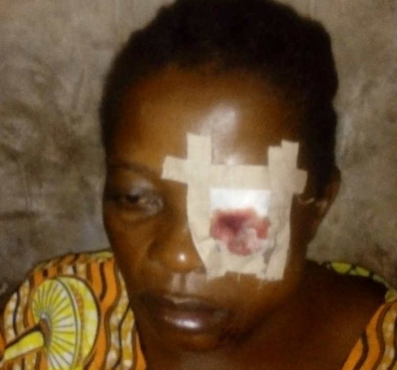 Kasaï : Agression criminelle à Nsumbula, une femme poignardée à l’oeil