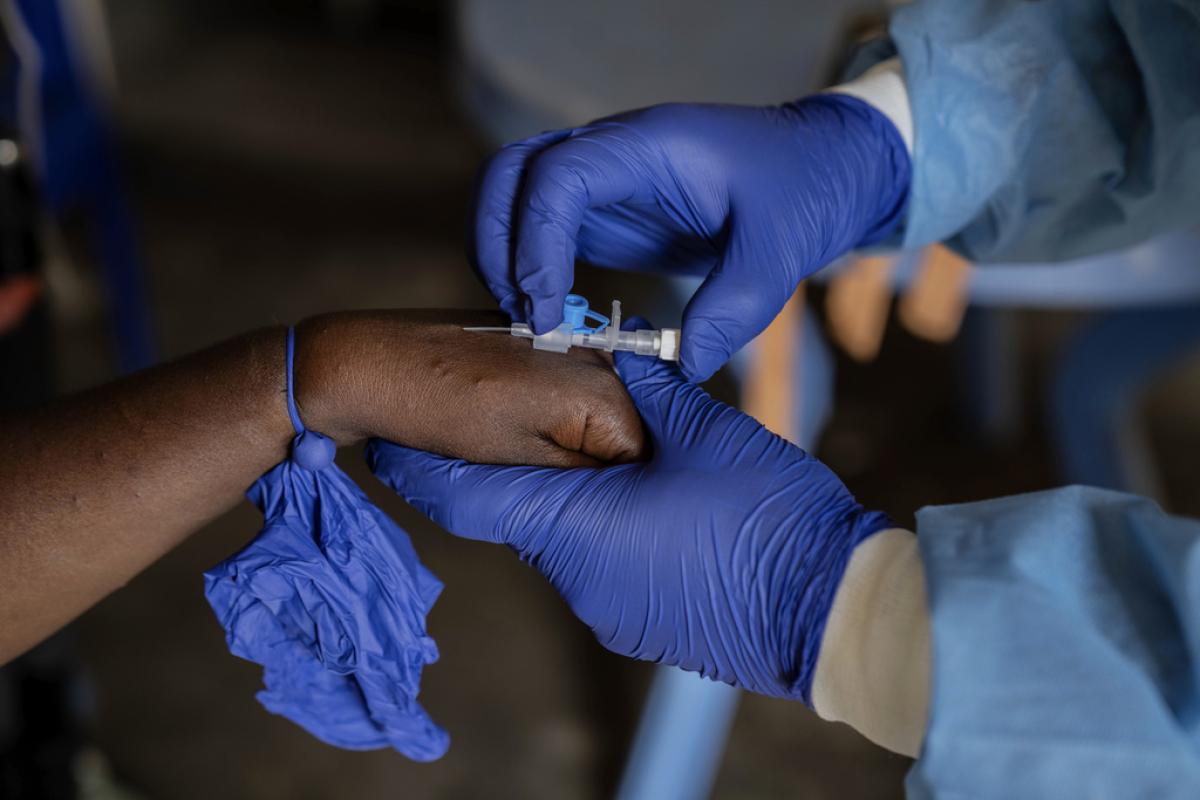 Épidémie de Monkeypox en RDC : Enjeux et Perspectives